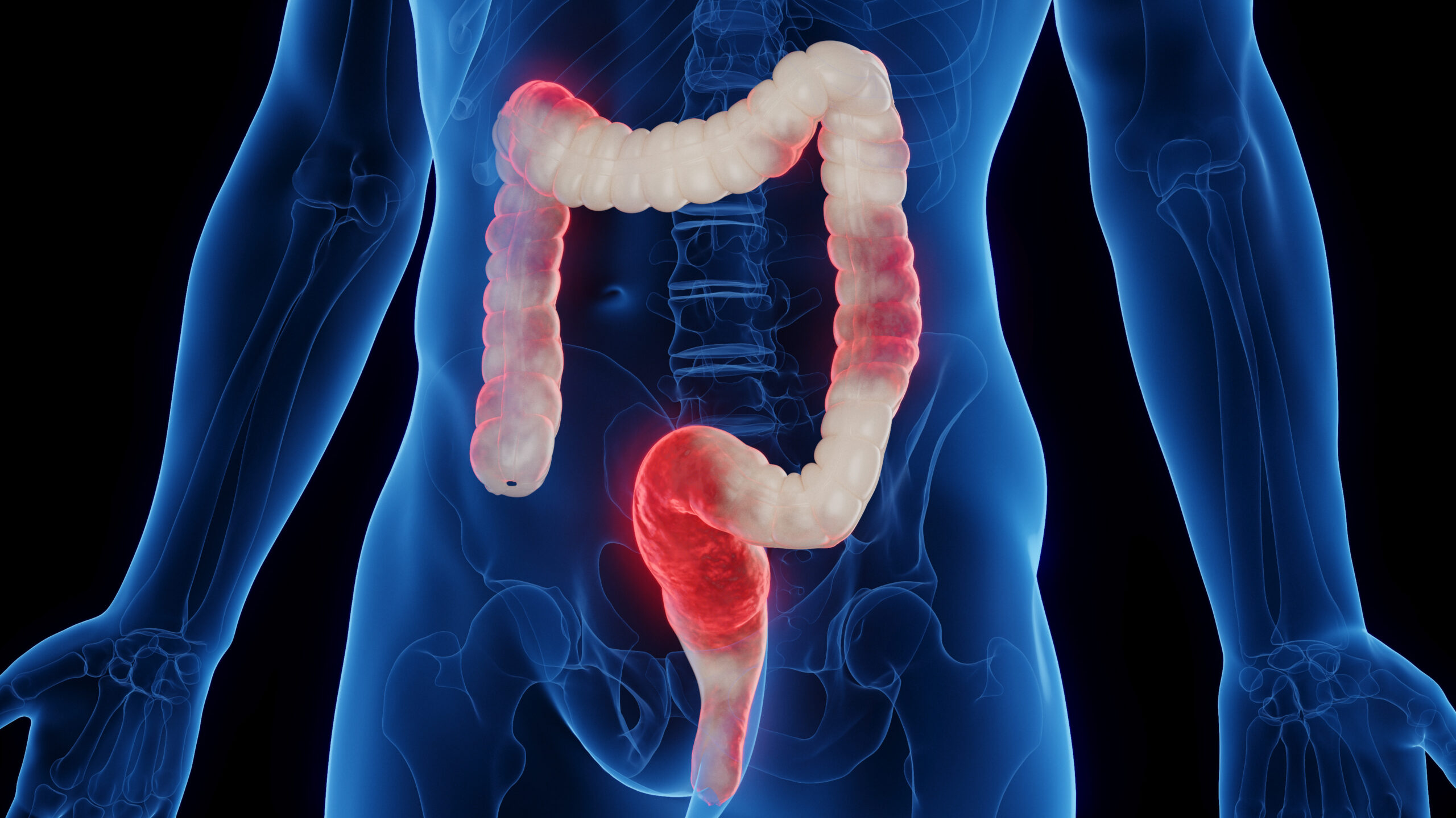 Gut Inc.